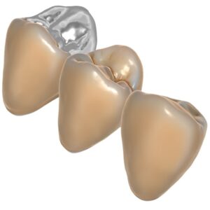 Örök licence - TrueSmile ™ modul