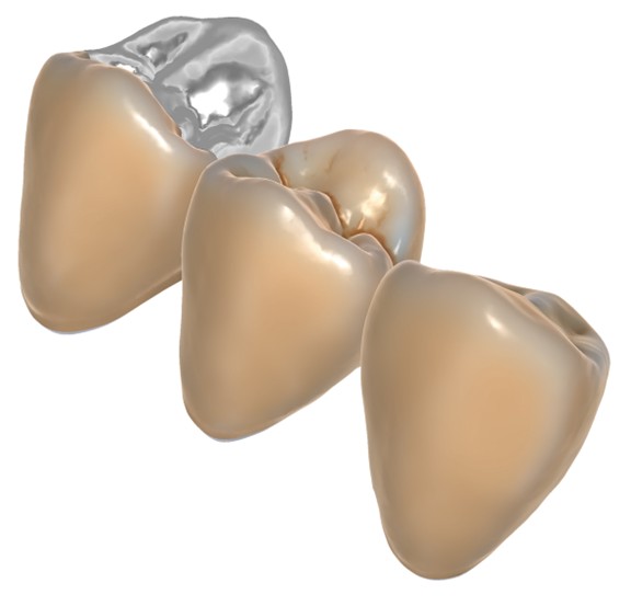 Örök licence - TrueSmile ™ modul