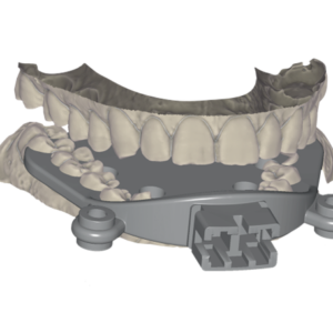 Örök licence - Állkapocs mozgás import Modul