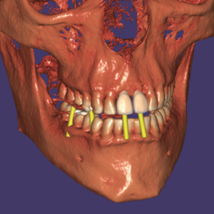 Örök licence - DICOM Viewer Modul