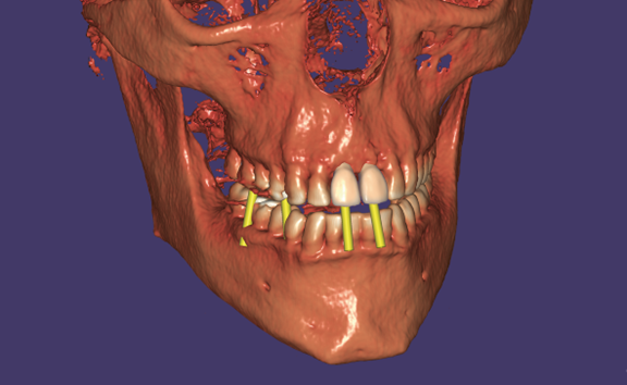 Örök licence - DICOM Viewer Modul