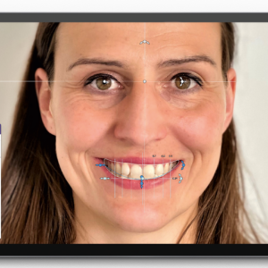 Örök licence - Mosolytervező Modul