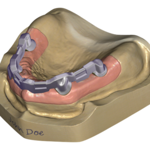Örök licence - Bár Modul