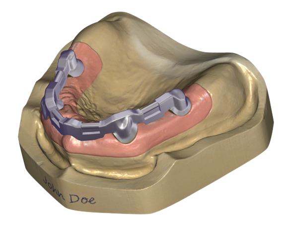 Örök licence - Bár Modul