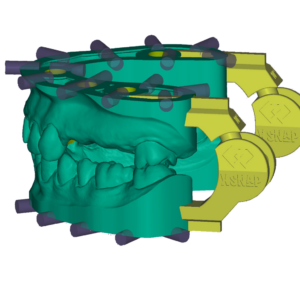 Örök licence - xSnap Modul