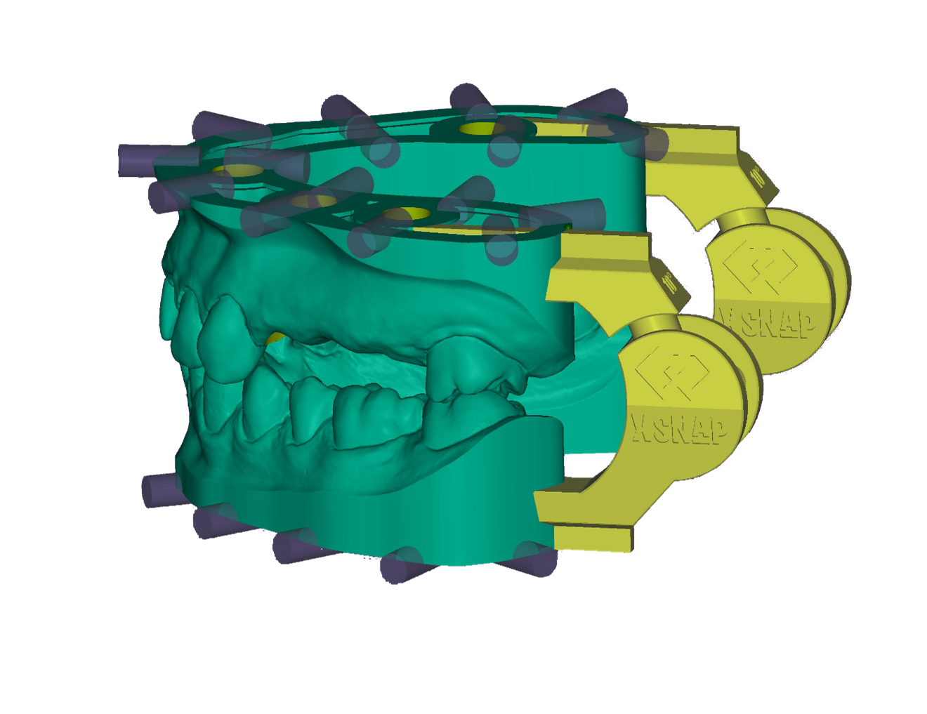 Örök licence - xSnap Modul
