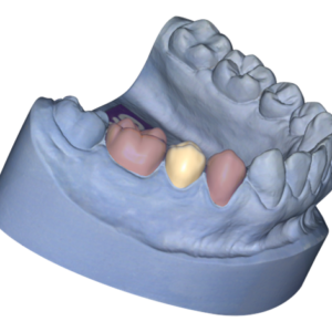 Örök licence - Ideiglenes Modul