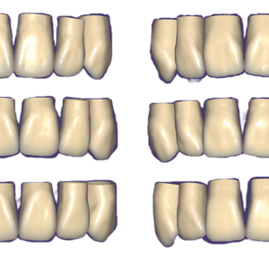 Örök licence - Inspira ™ fogsor könyvtár Modul