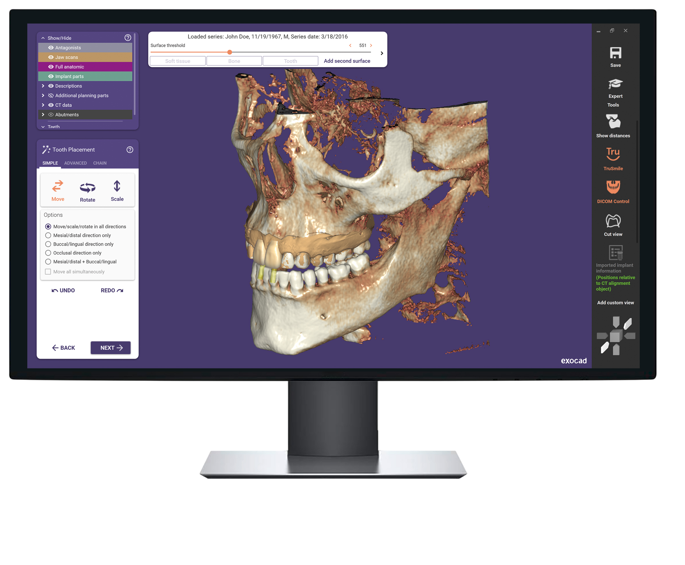 Örök licenc - DICOM Viewer Modul