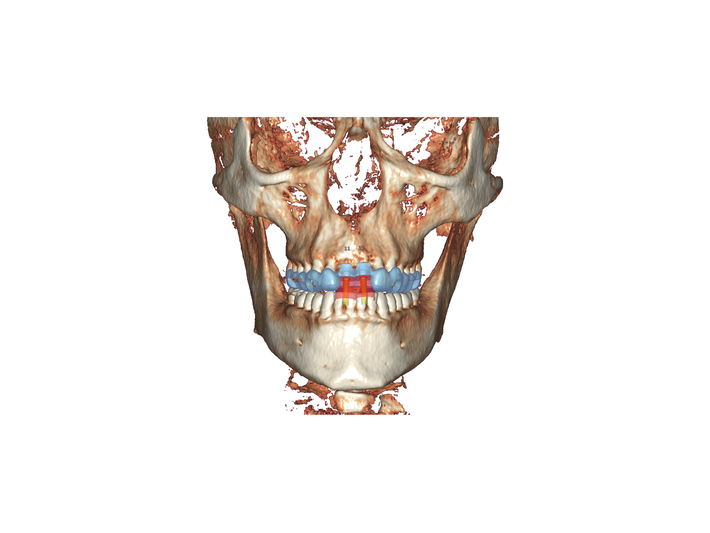 Rugalmas licenc - DICOM Viewer Modul
