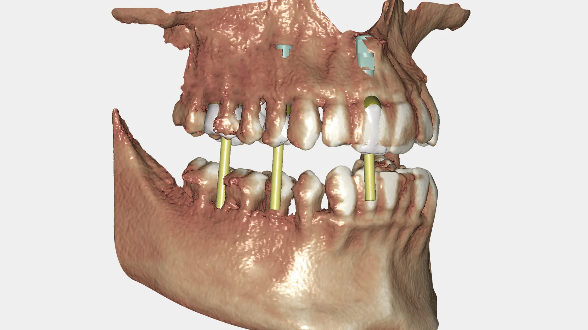 Örök licenc - DICOM Viewer Modul