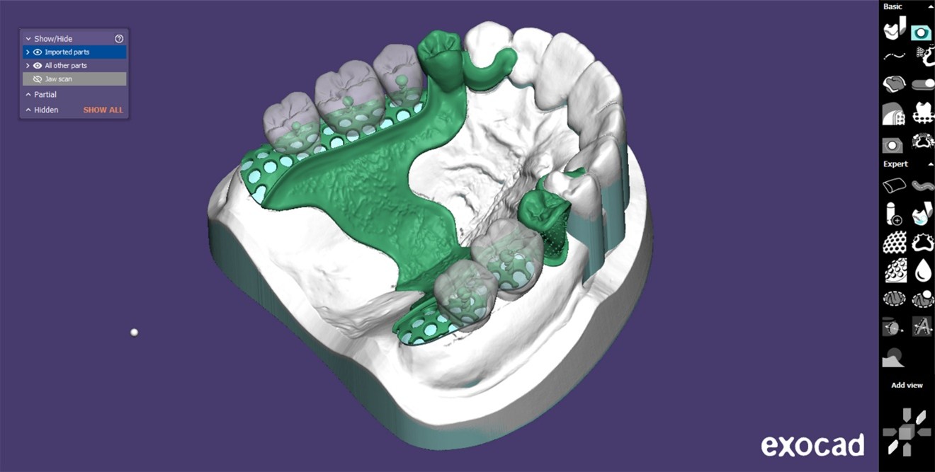 Fogászati lemez modul